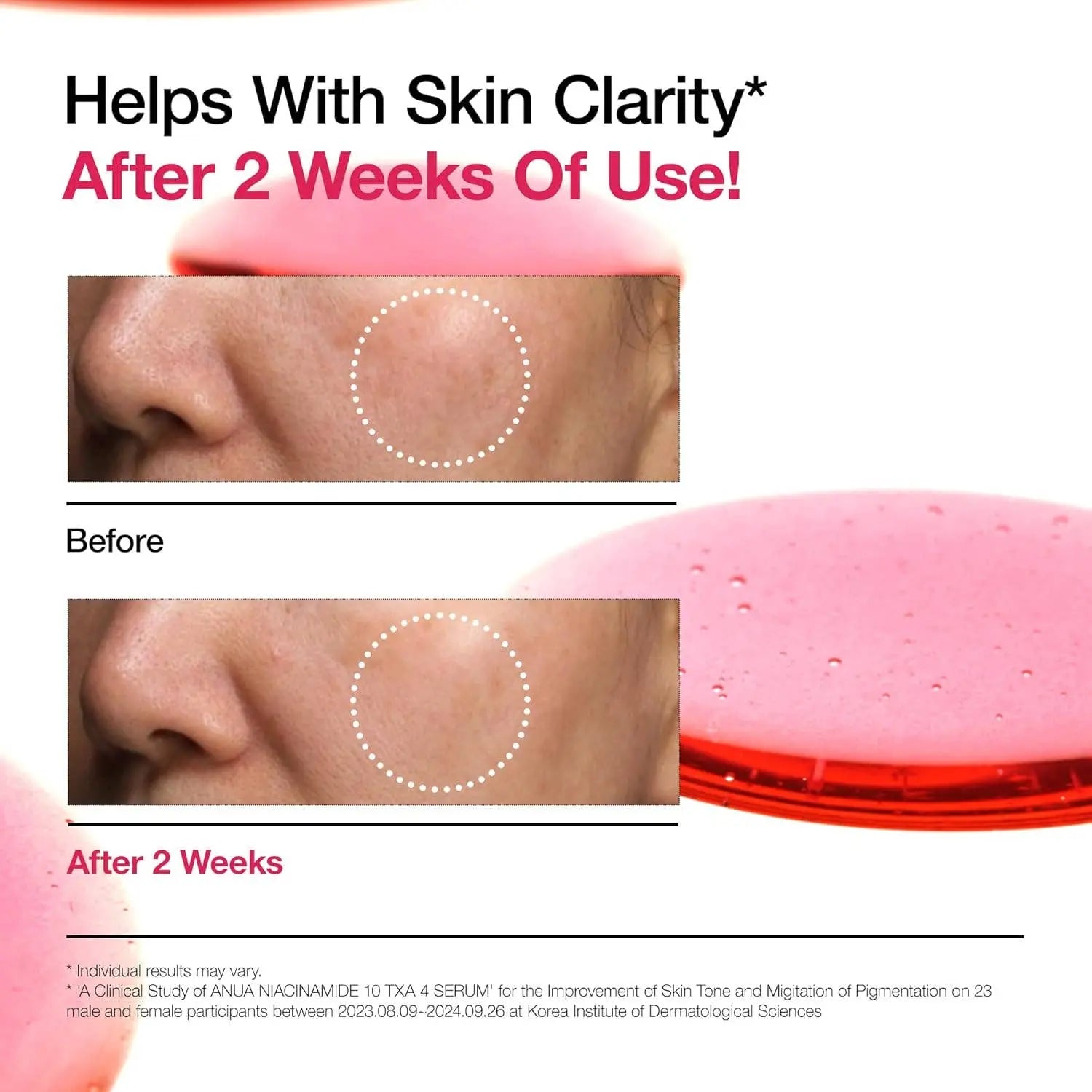 Korean Glass Skin Serum with 10% Niacinamide, 4% Tranexamic Acid, 2% Arbutin for brightening and pore care in Korean skincare routine.