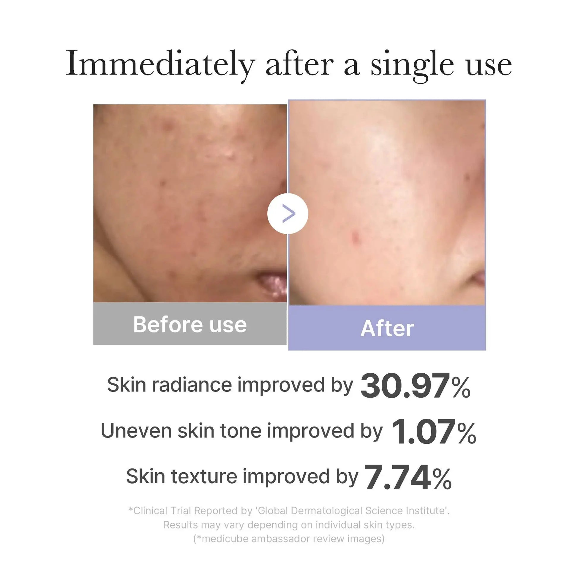 [Medicube] Mini Booster Pro Kosmic - Kbeauty Skincare shop name 
