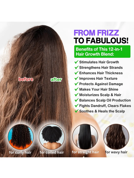 Selfwise Rosemary and Castor Oil for Hair & Scalp - NextGen Glam