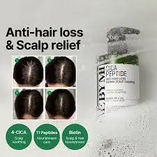Some By Mi Cica Peptide Anti Hair Loss Derma Scalp Tonic NextGen Glam shop name 